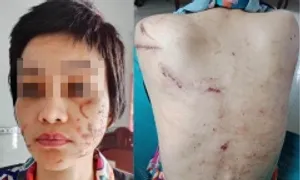 Khi bị người thân đánh, cần làm gì để thoát khỏi bạo lực gia đình? Khi bị người thân đánh, cần làm gì để thoát khỏi bạo lực gia đình?